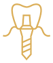 Dental Implants in Edmonton